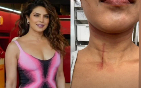 ଆହତ ହେଲେ ପ୍ରିୟଙ୍କା