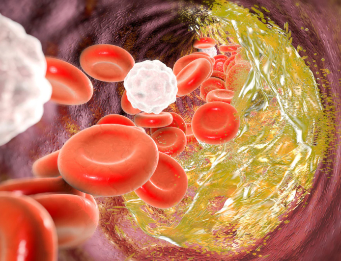 କୋଲେଷ୍ଟ୍ରଲରୁ ରକ୍ଷା ପାଇବା ପାଇଁ କରନ୍ତୁ ଏହି କାମ